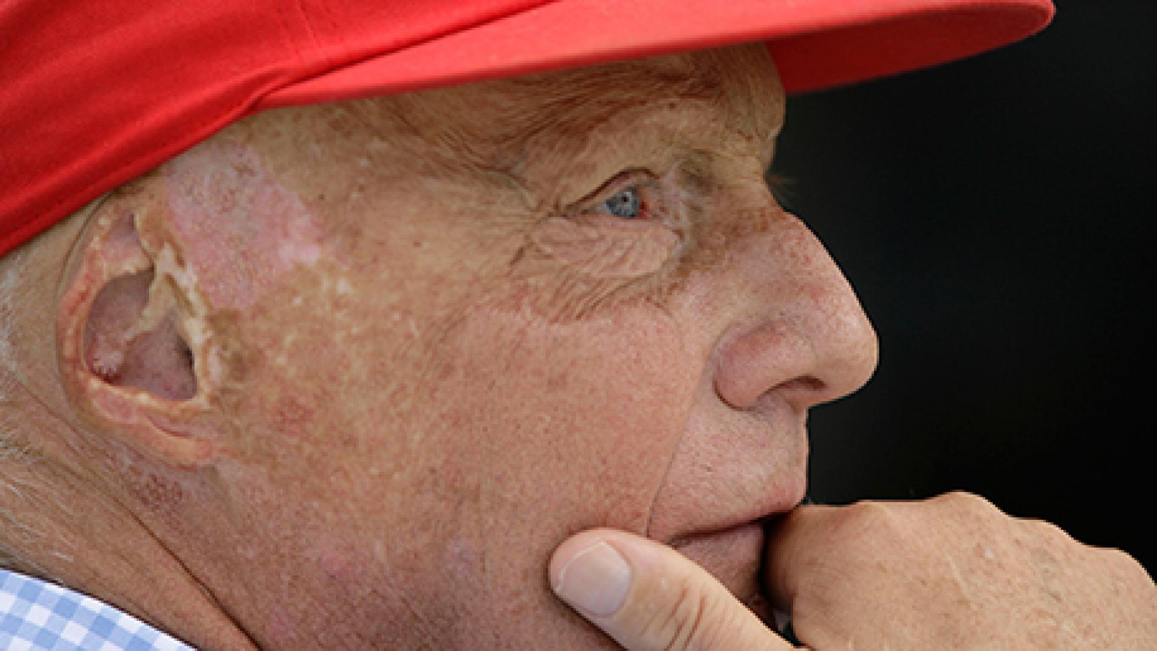 Niki Lauda, grave tras un trasplante de pulmón